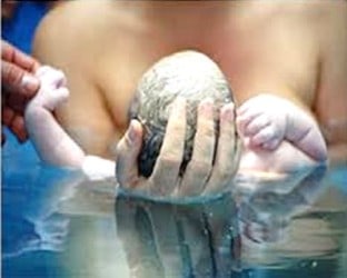 nascimento na agua parto humanizado