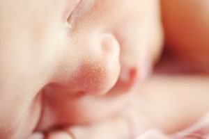 Brotoeja em Bebê – O que é, Principais Causas, Sintomas & Tratamento