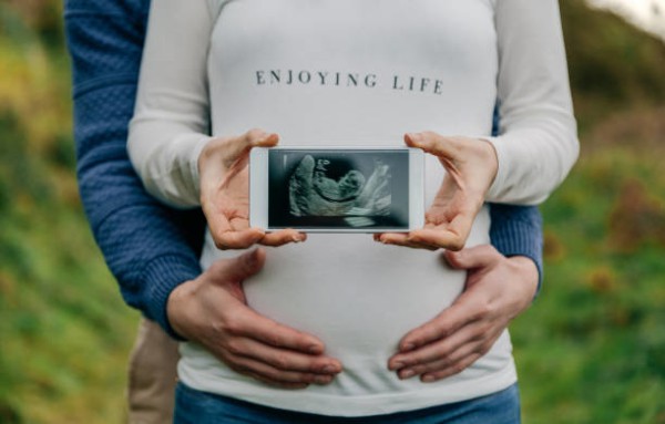 foto para anunciar a gravidez com imagem do ultrassom