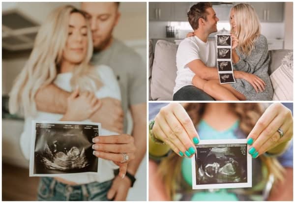 fotos com ultrassom para divulgar gravidez